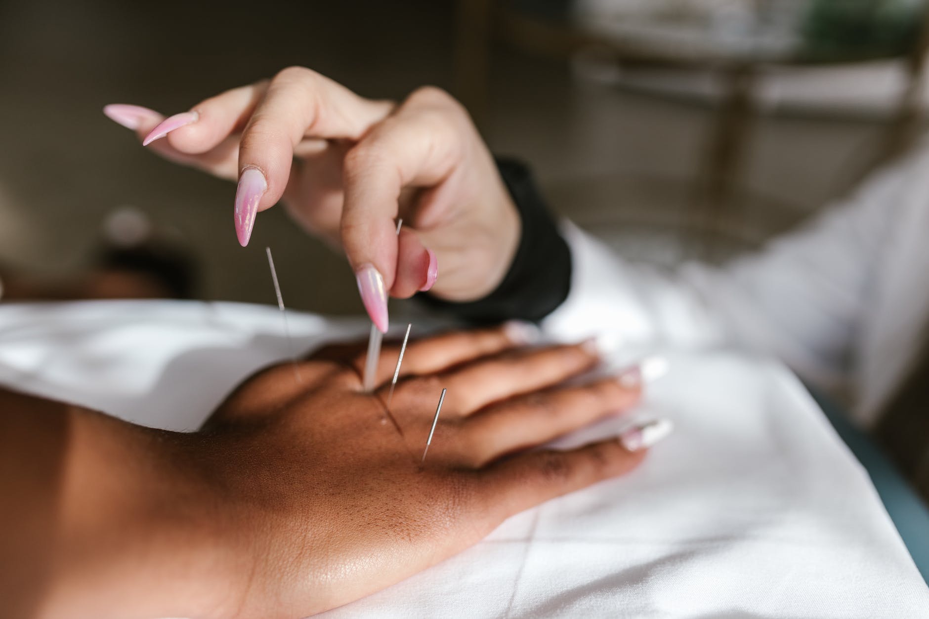 close up shot of a person doing an acupuncture